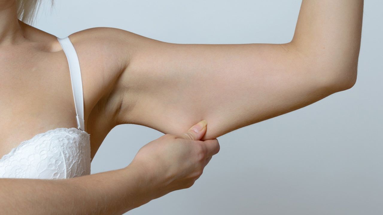 How to Avoid Loose Skin After Weight Loss