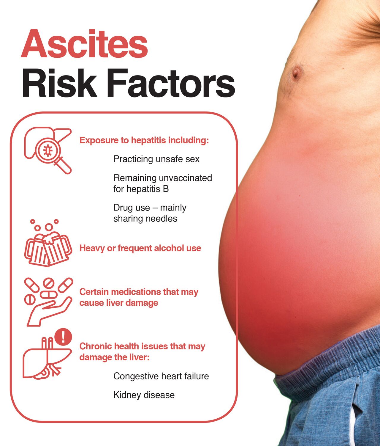 Risk factors for ascites