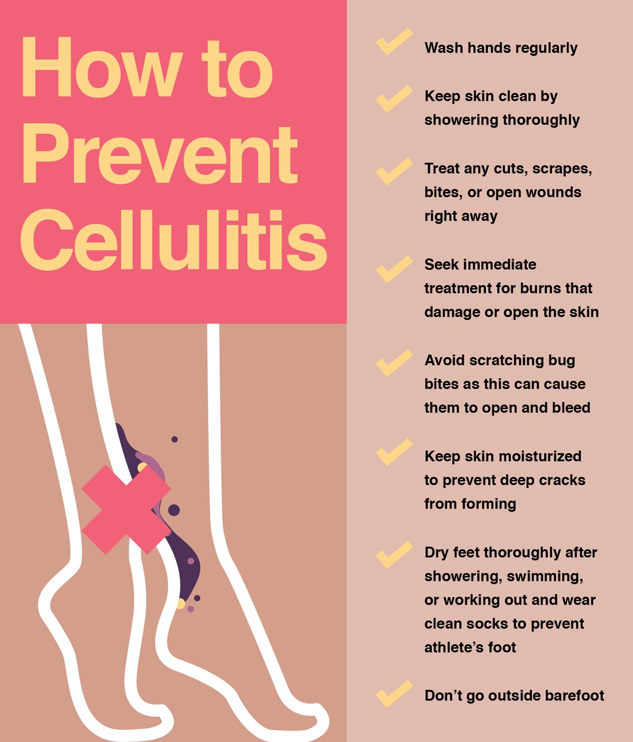 How to prevent cellulitis