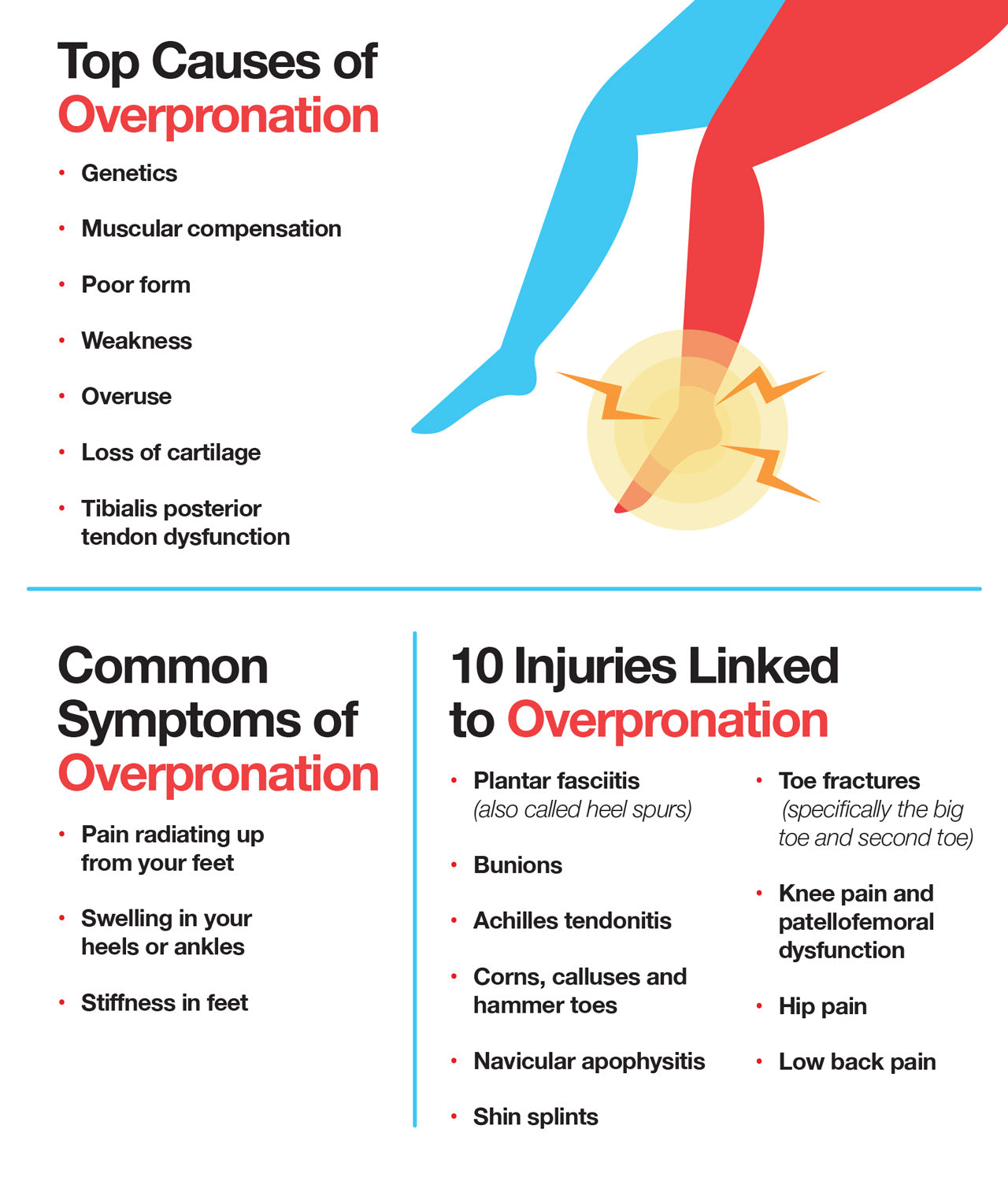 Here are the top causes of overpronation and symptoms for it.