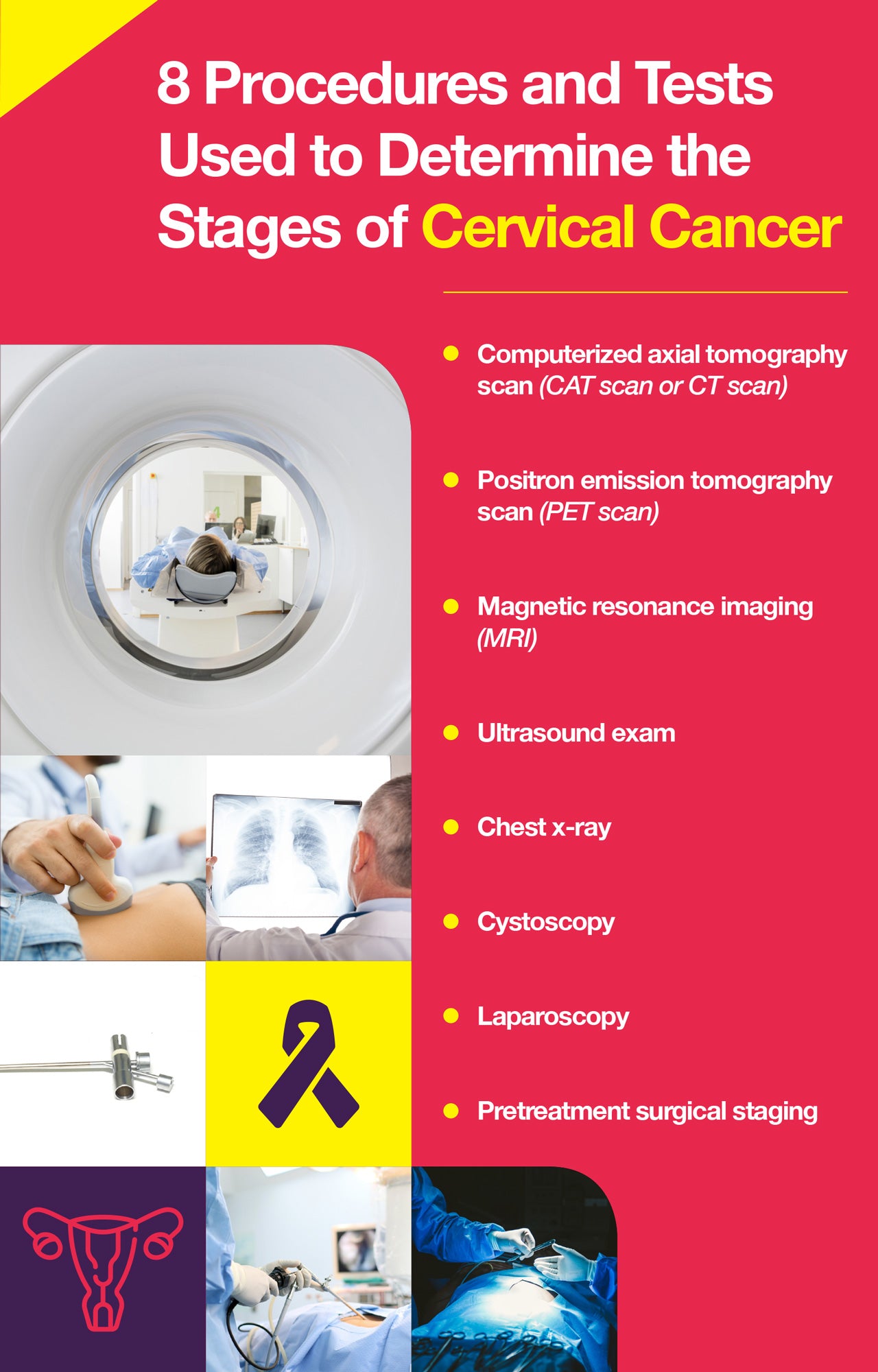 Testing for cervical cancer
