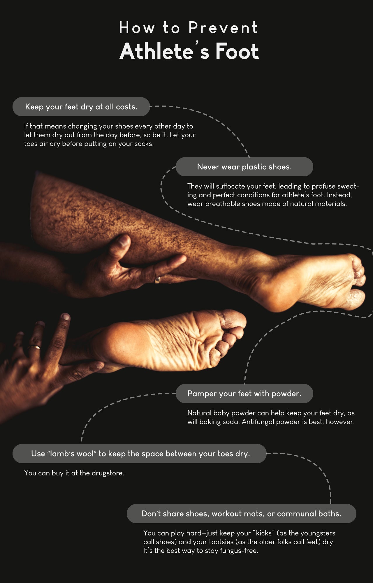 How to prevent athlete’s foot 
