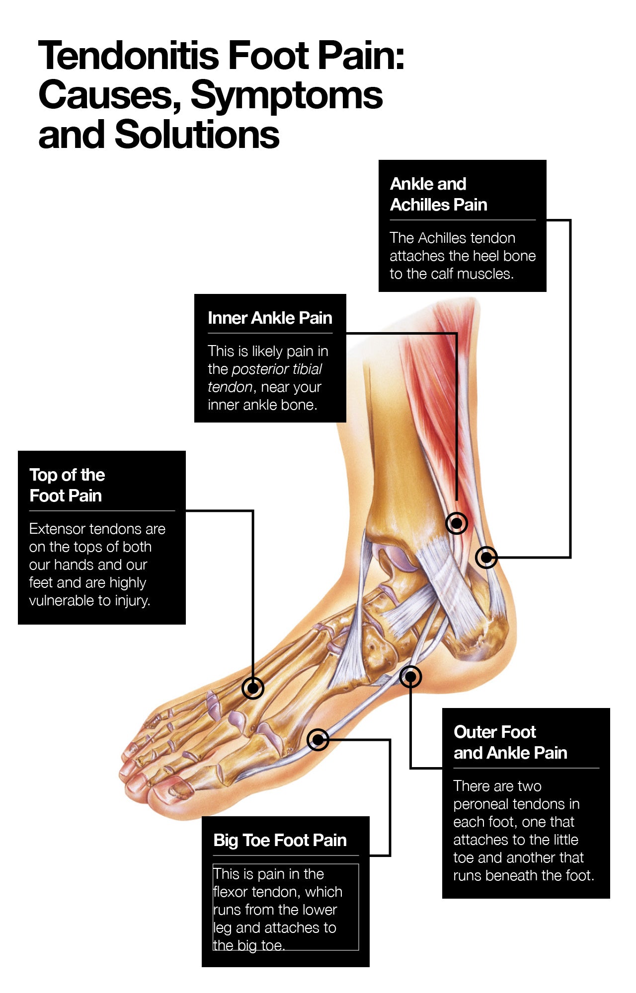 Tendonitis foot pain: causes, symptoms, and solutions.