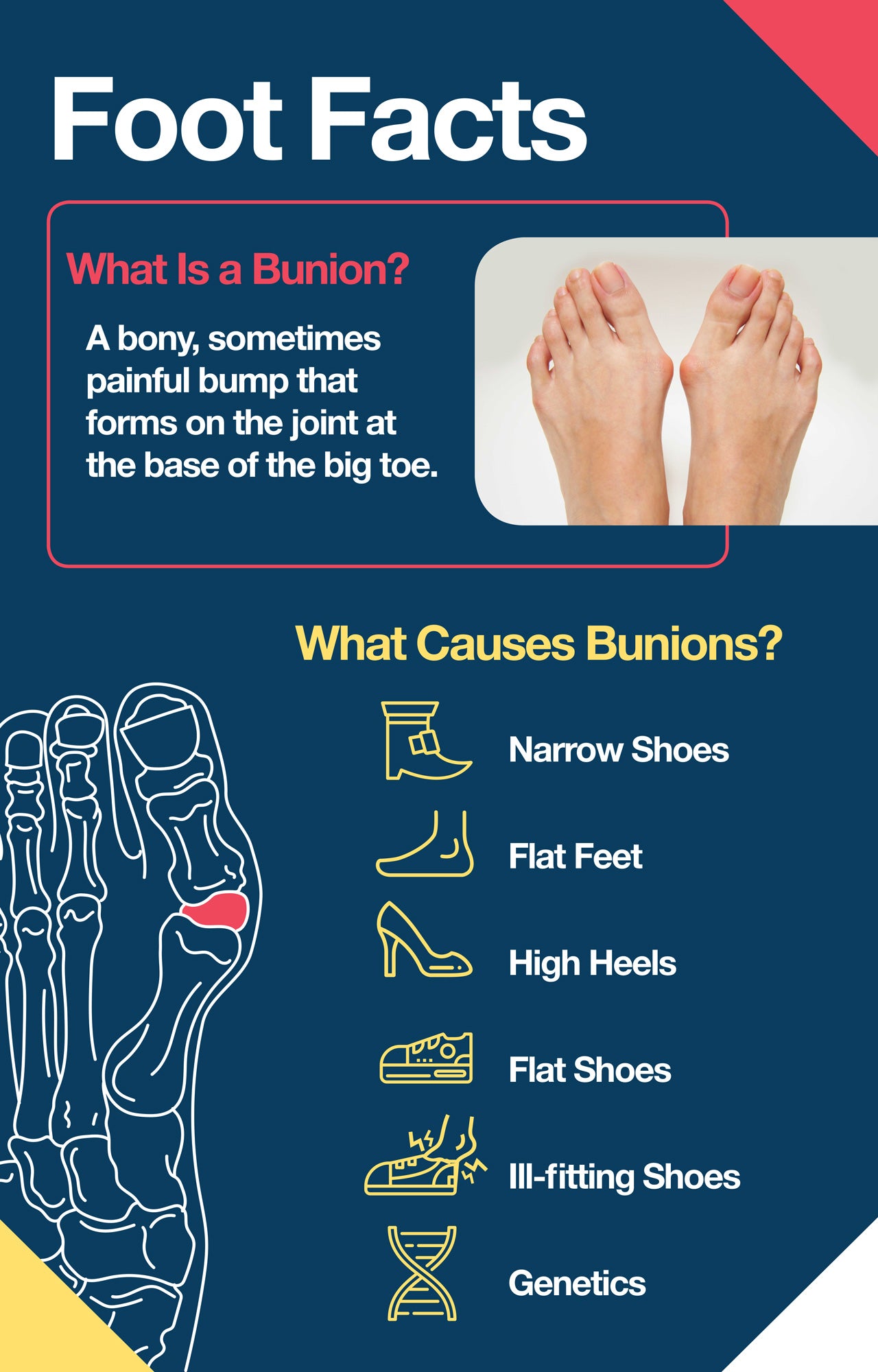 bunion foot facts