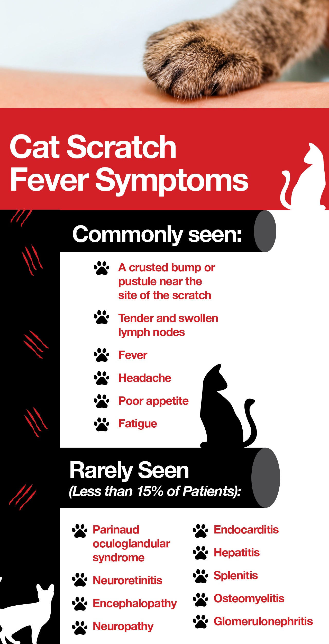 Cat scratch fever symptoms