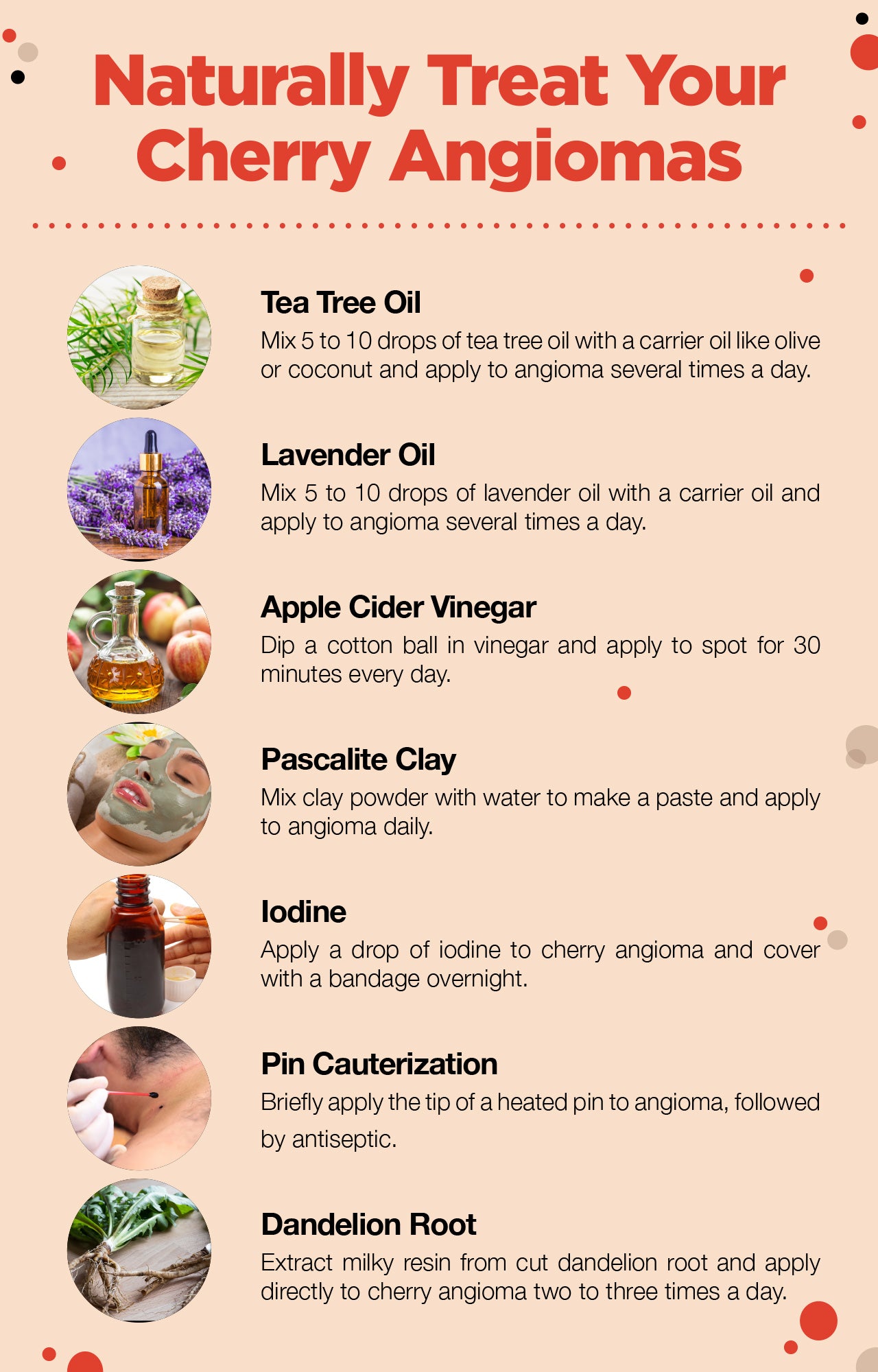 Natural treatments for cherry angioma
