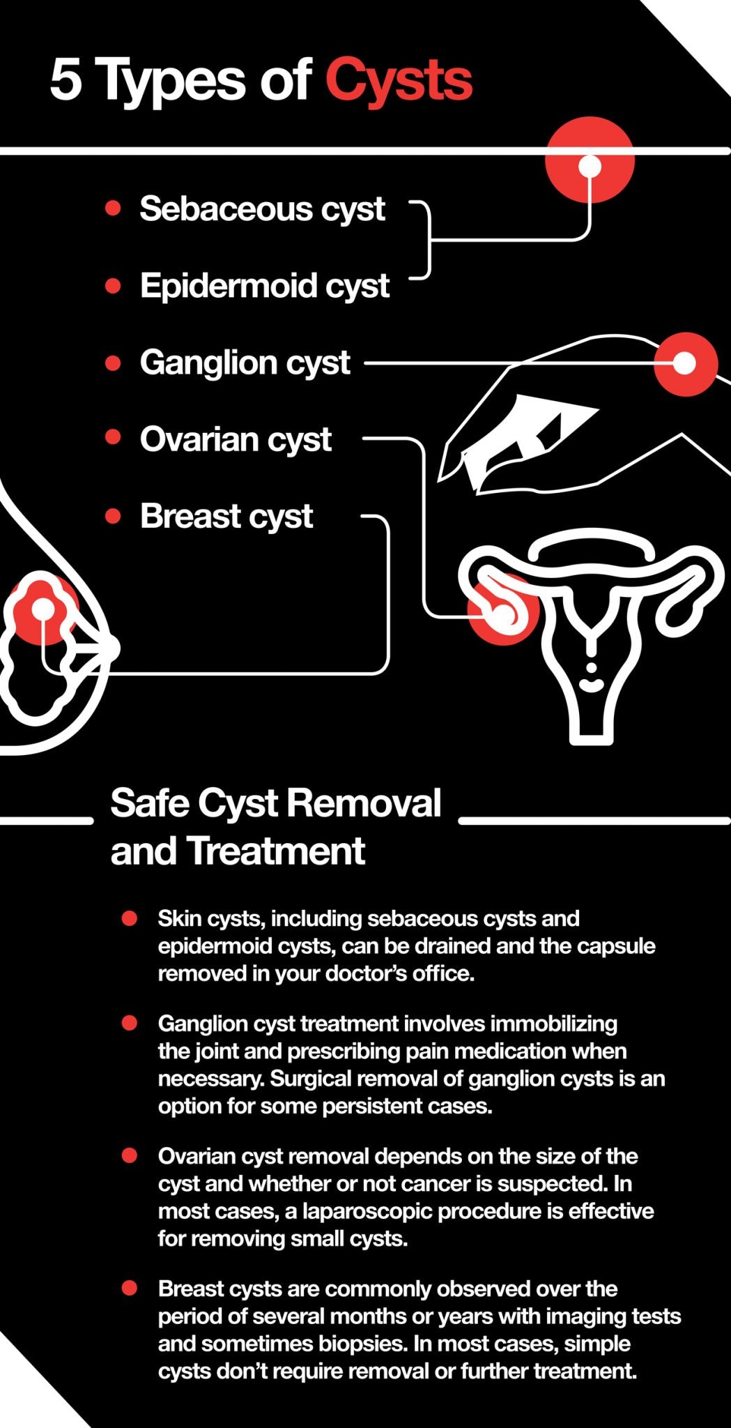 If you are tempted to squeeze a cyst—stop!