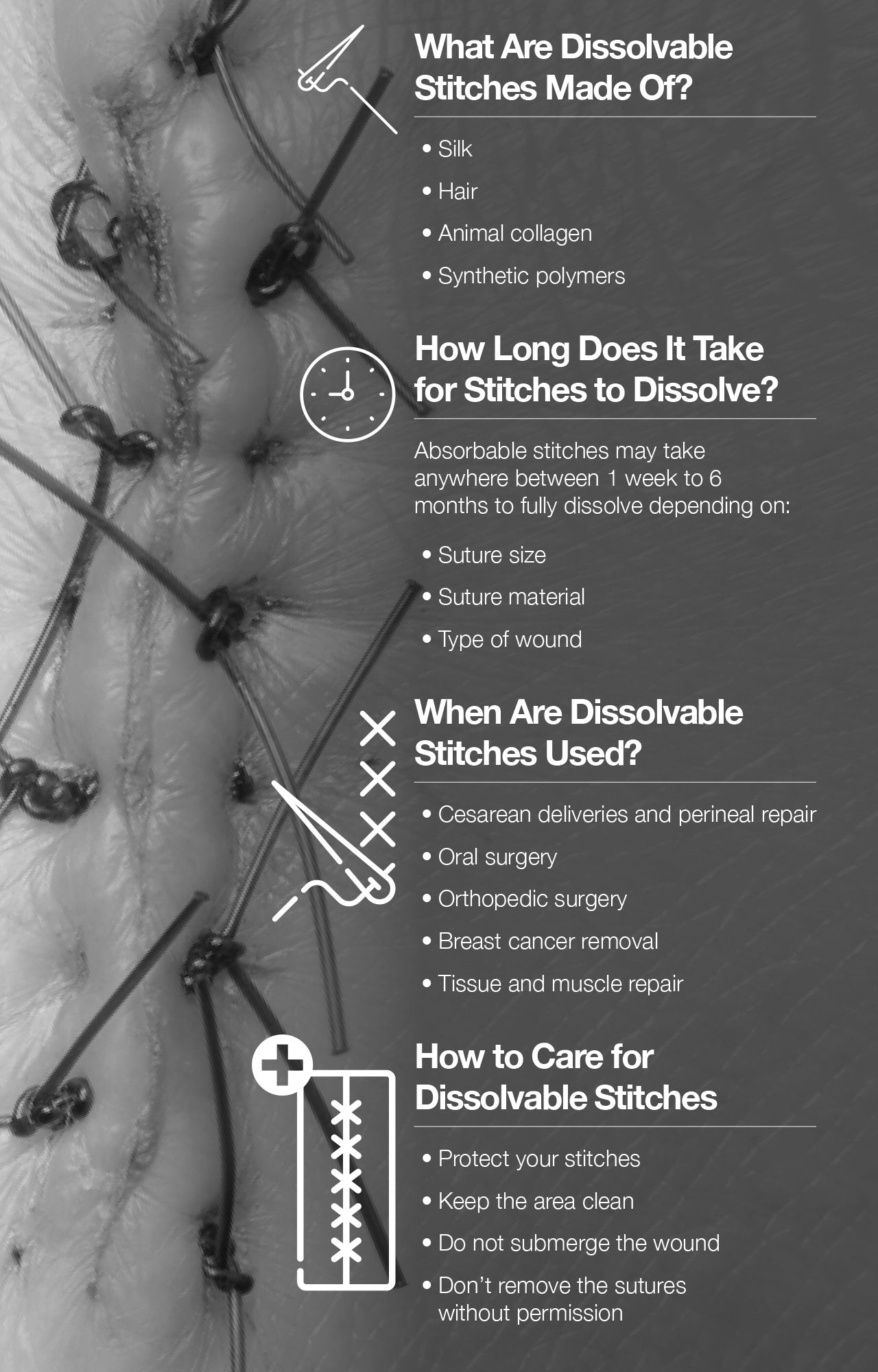 What Are Dissolvable Stitches Made Of?
