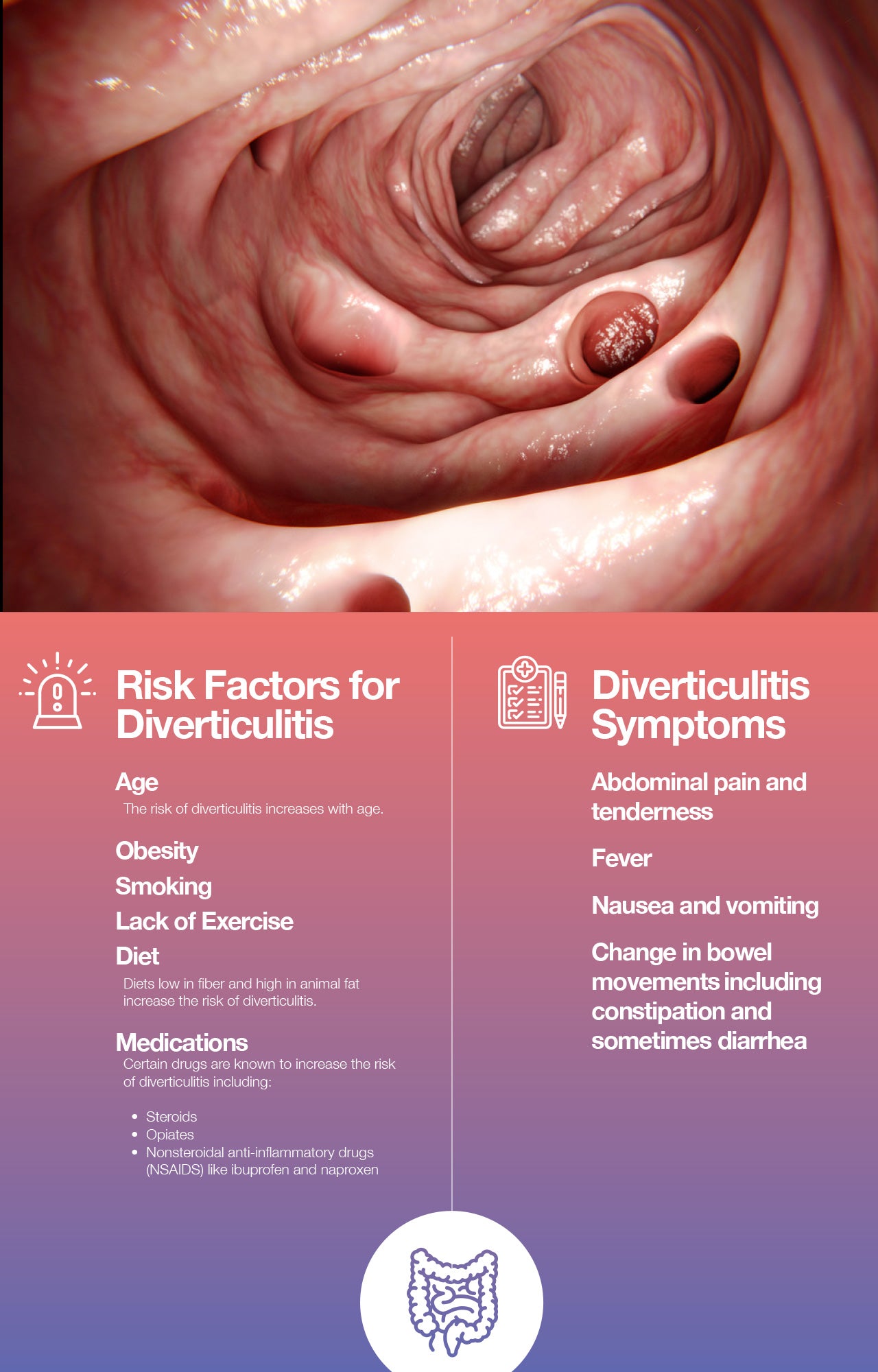 Prevent diverticulosis and diverticulitis