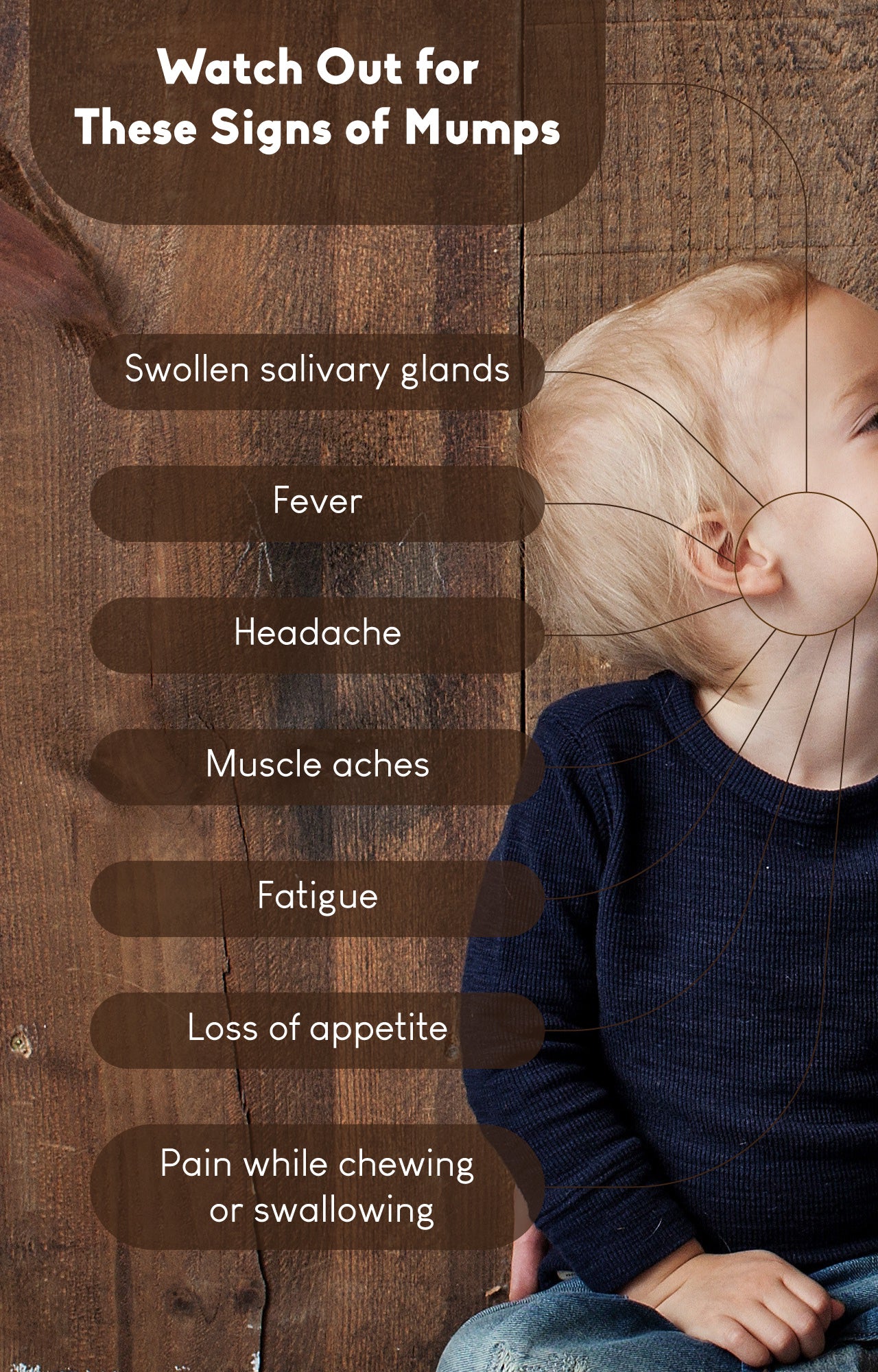 Warning signs of mumps