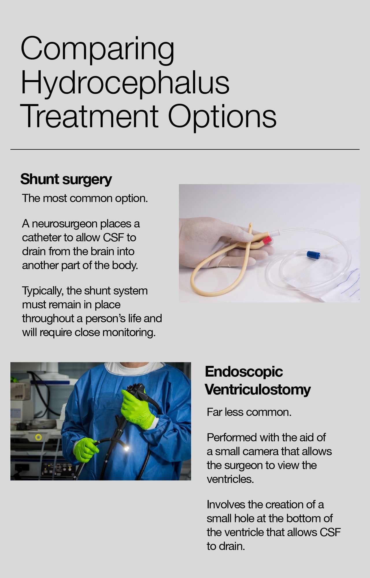 Comparing Hydrocephalus Treatment Options