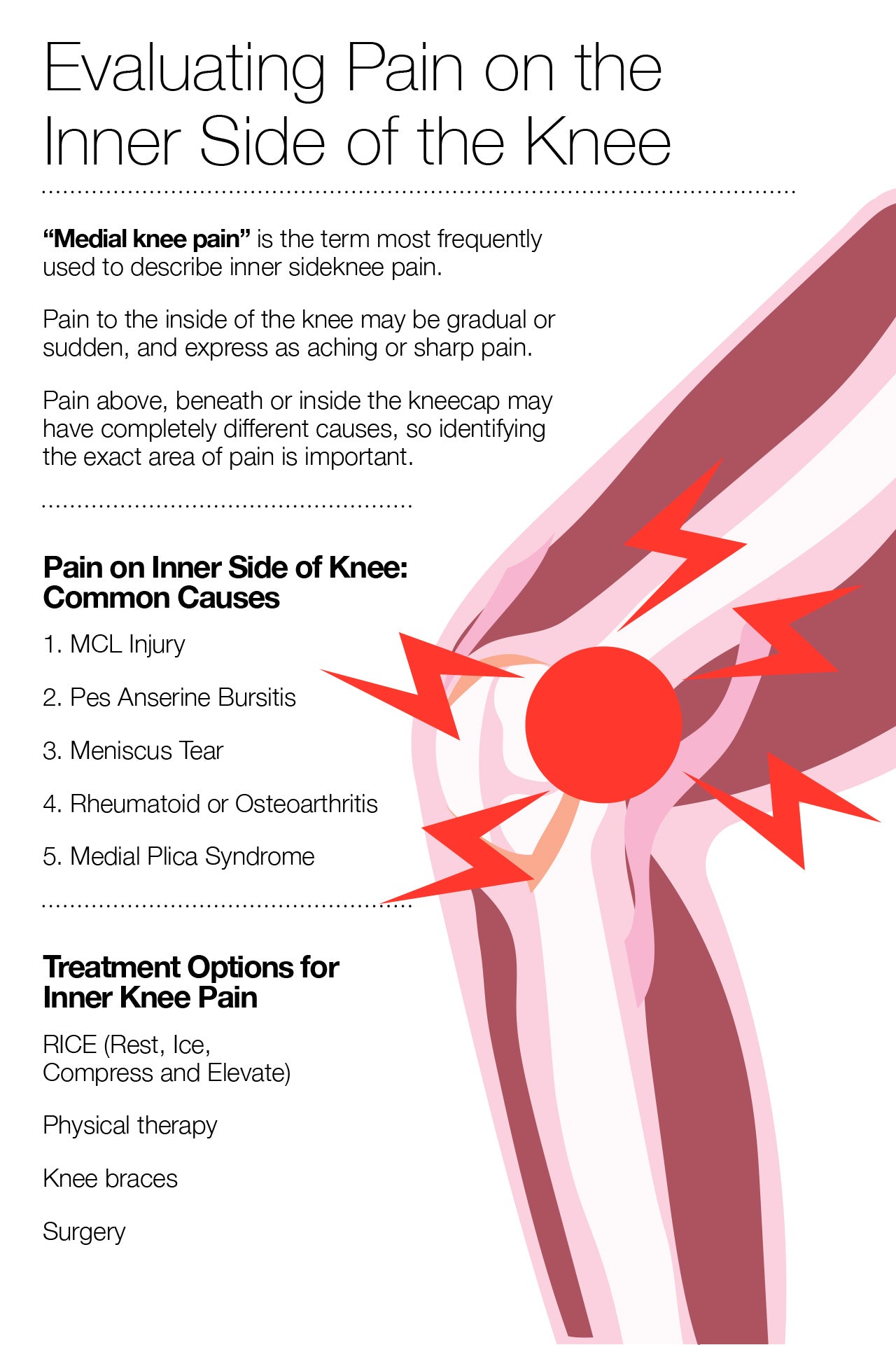 Evaluating Pain on the Inner Side of the Knee