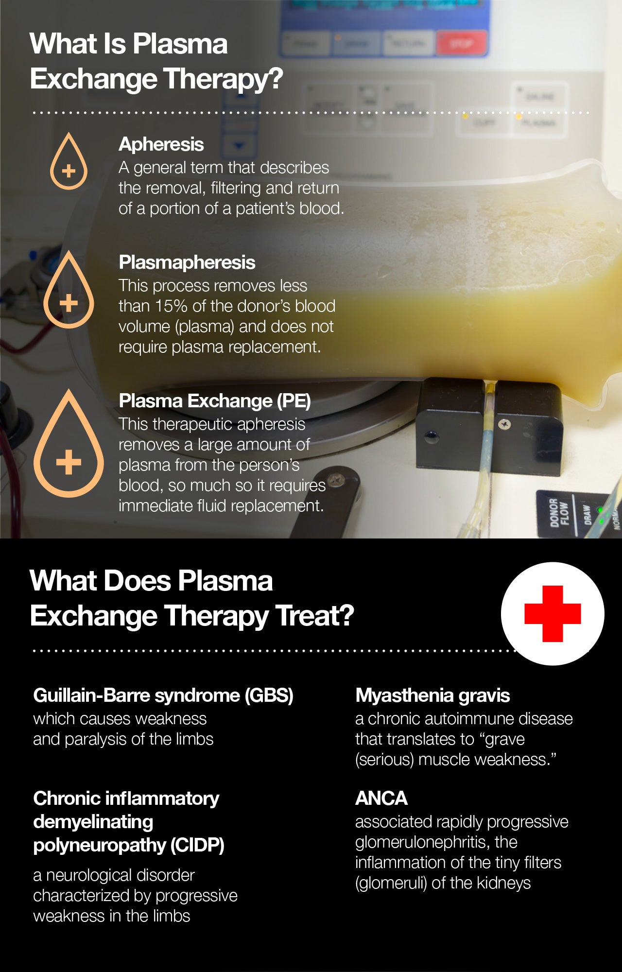 What is plasma exchange therapy?