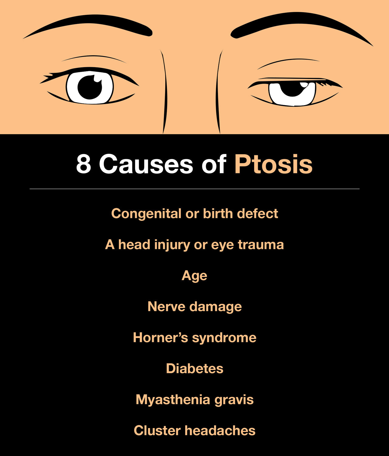 Causes of ptosis