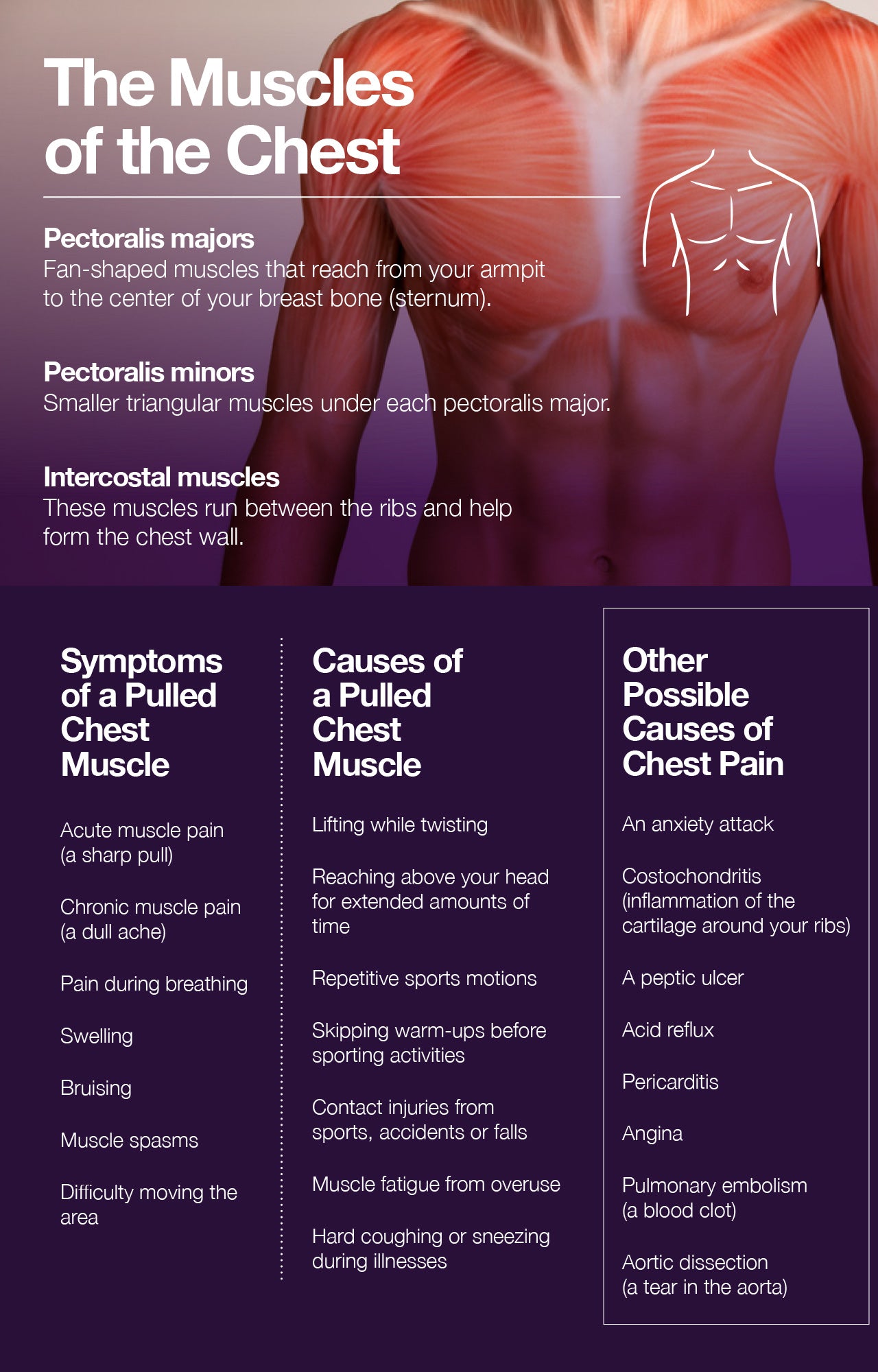 Pulled chest muscle: signs, causes, and treatment.