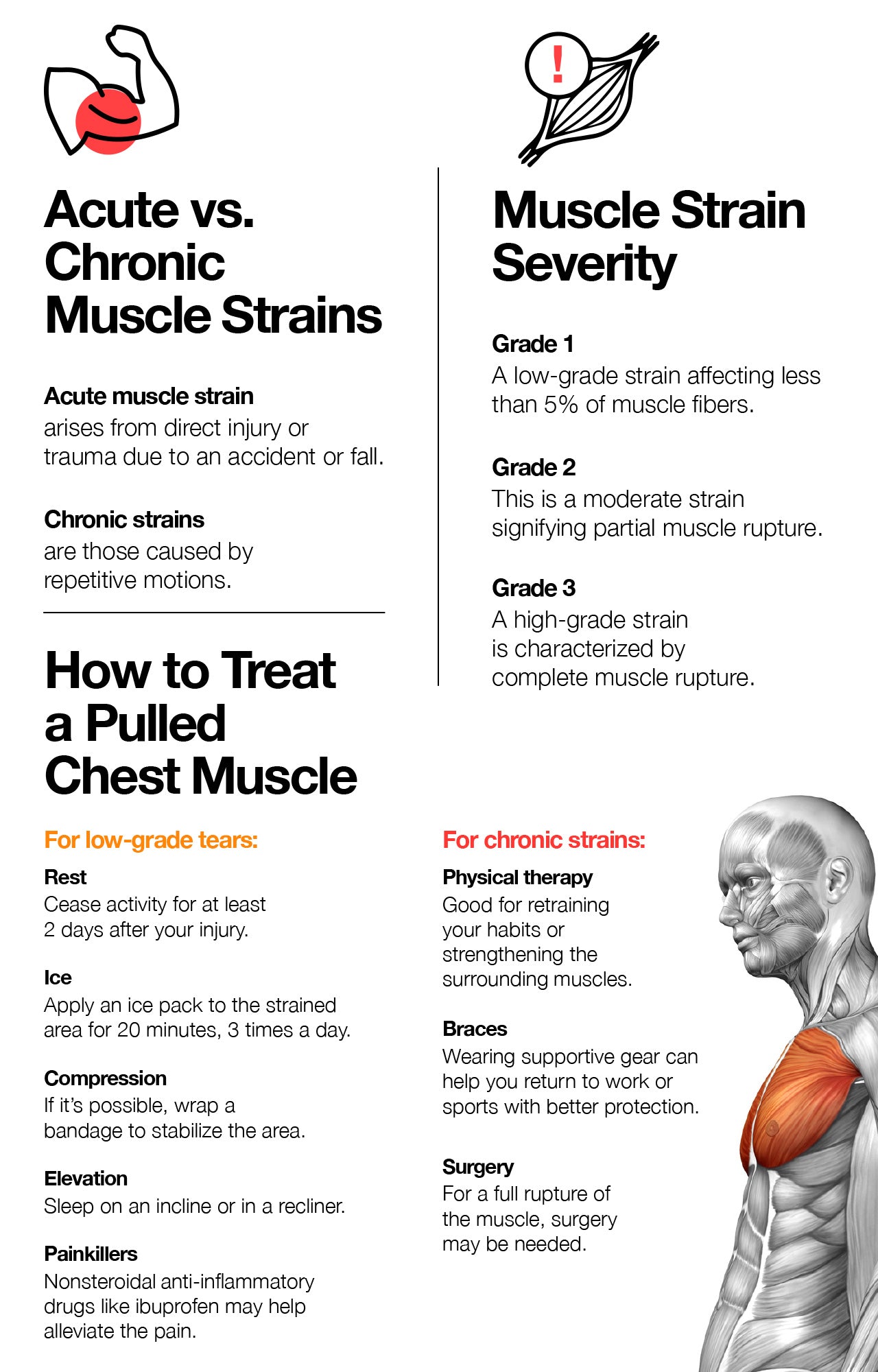 Pulled chest muscle: signs, causes, and treatment.