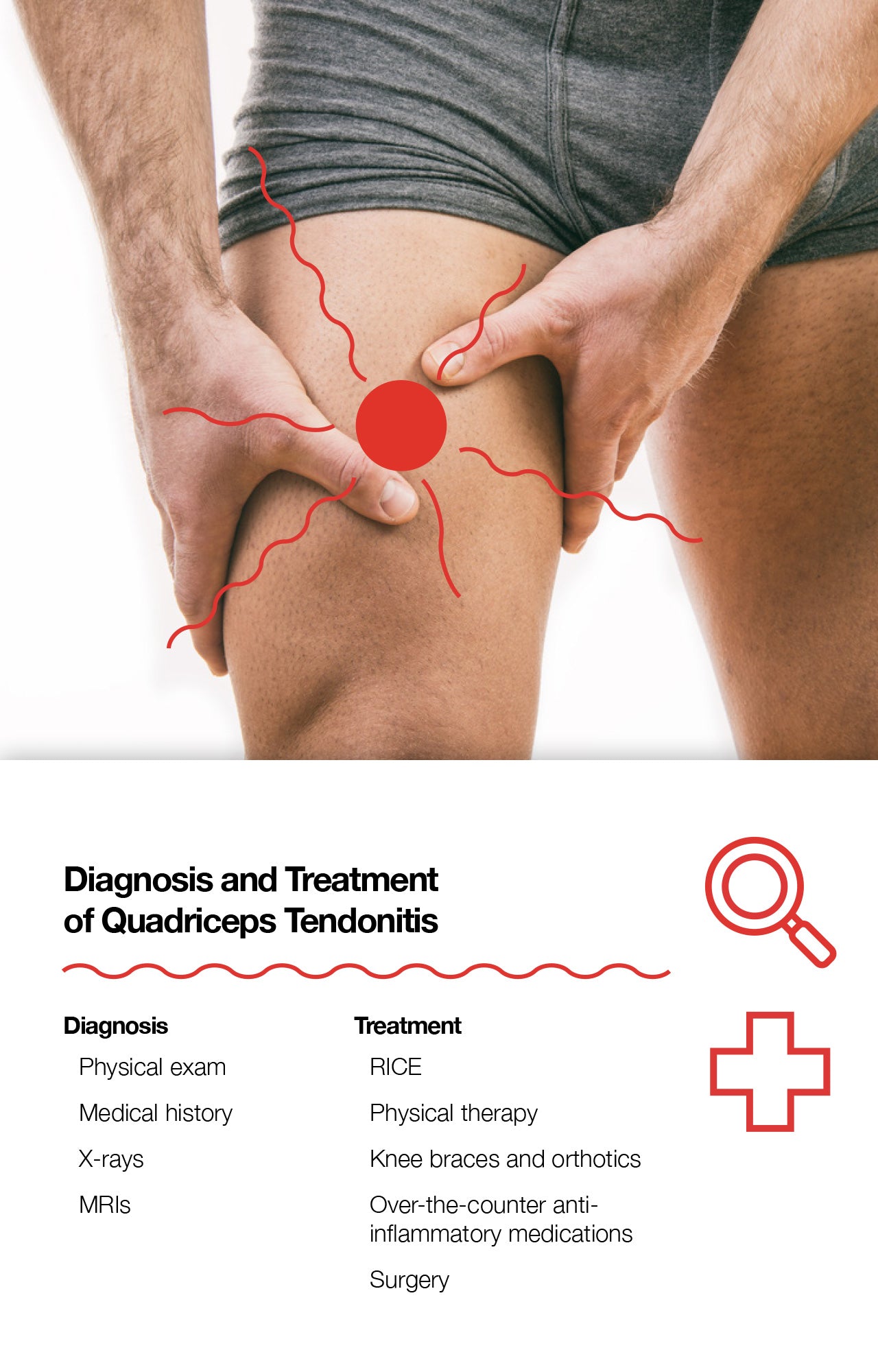 Diagnosis and Treatment of Quadriceps Tendonitis