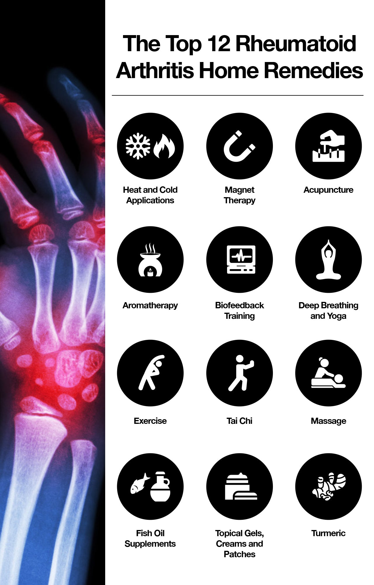The top 12 rheumatoid arthritis home remedies.