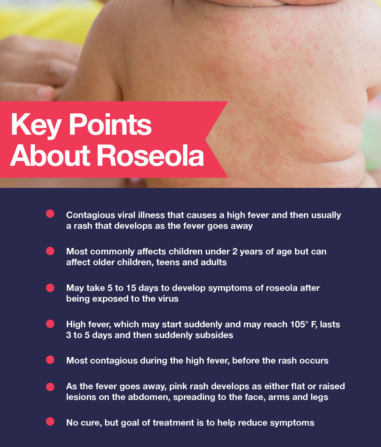 Facts about roseola
