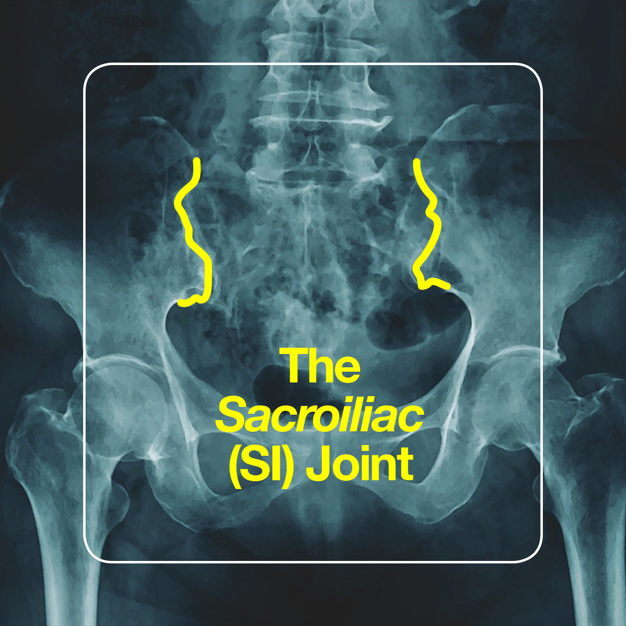 SI joint pain: causes and treatments.