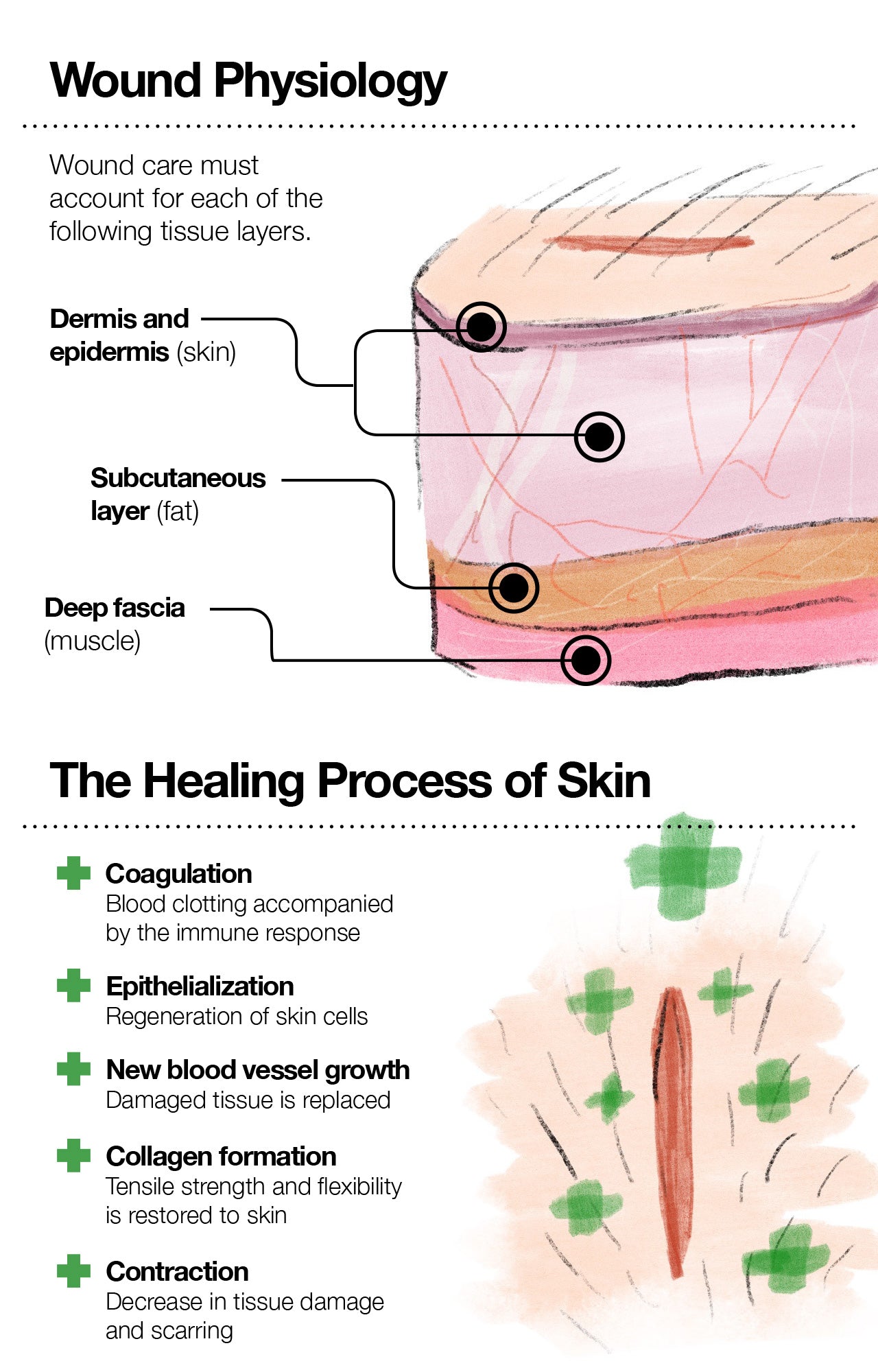 Wound Physiology