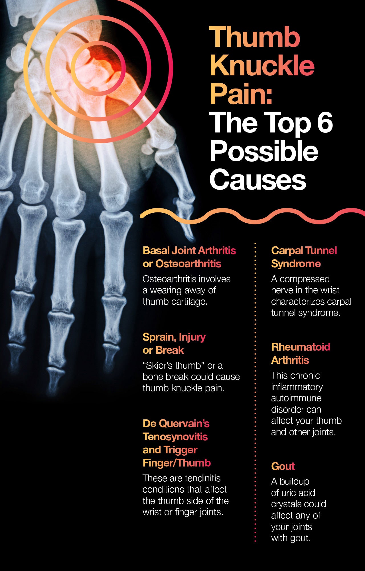 Thumb knuckle pain: top 6 possible causes.