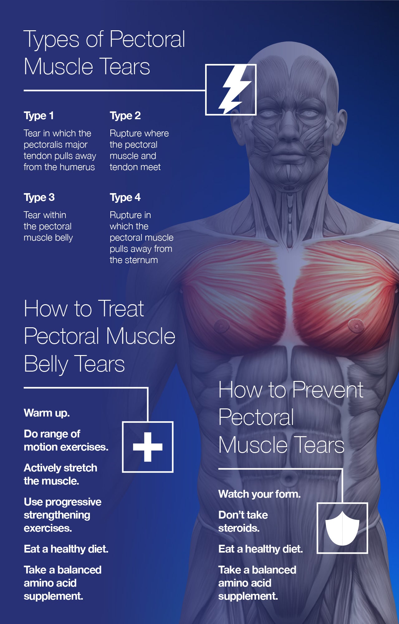 Types of Pectoral Muscle Tears