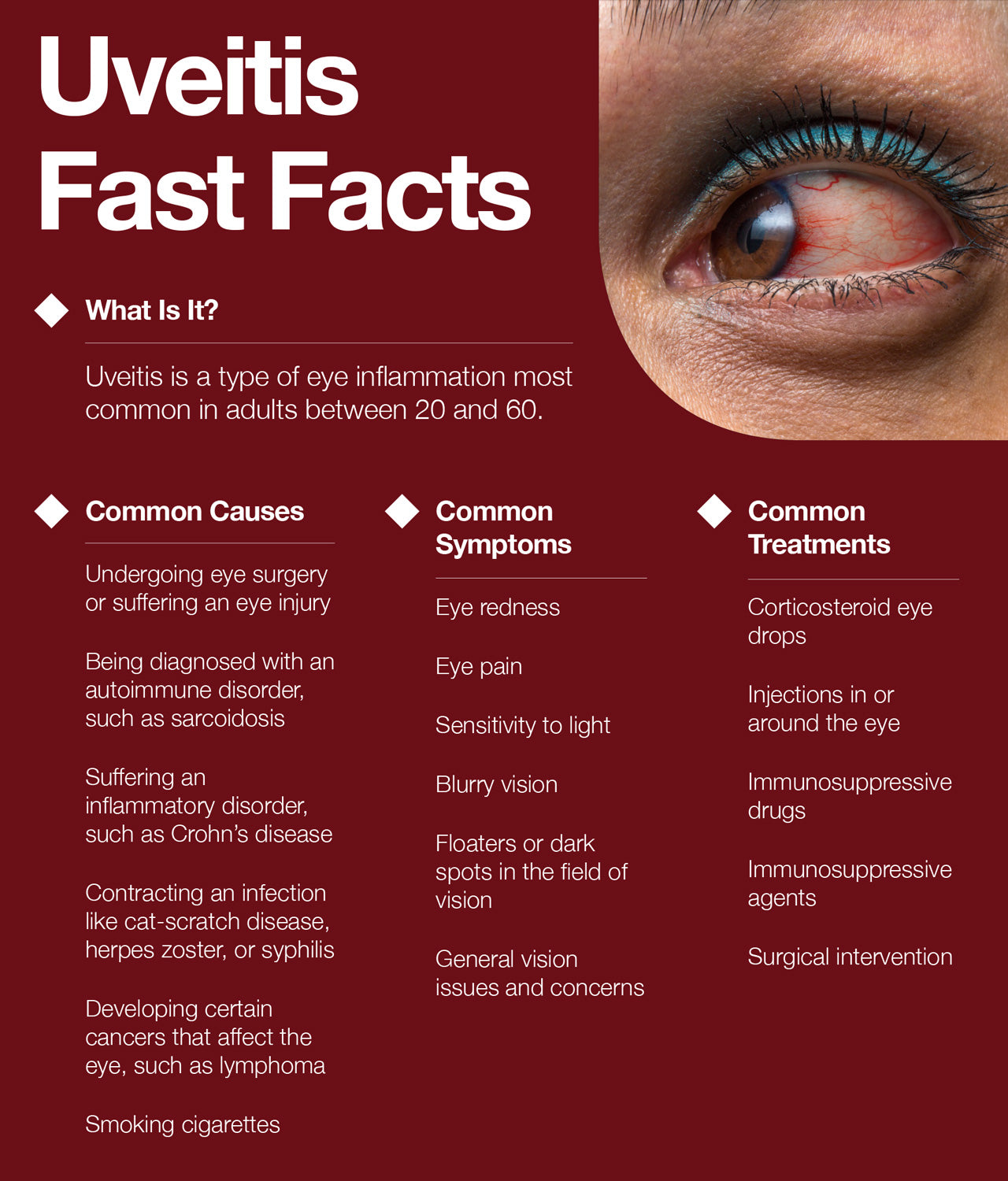 Uveitis Causes, Symptoms, Treatment