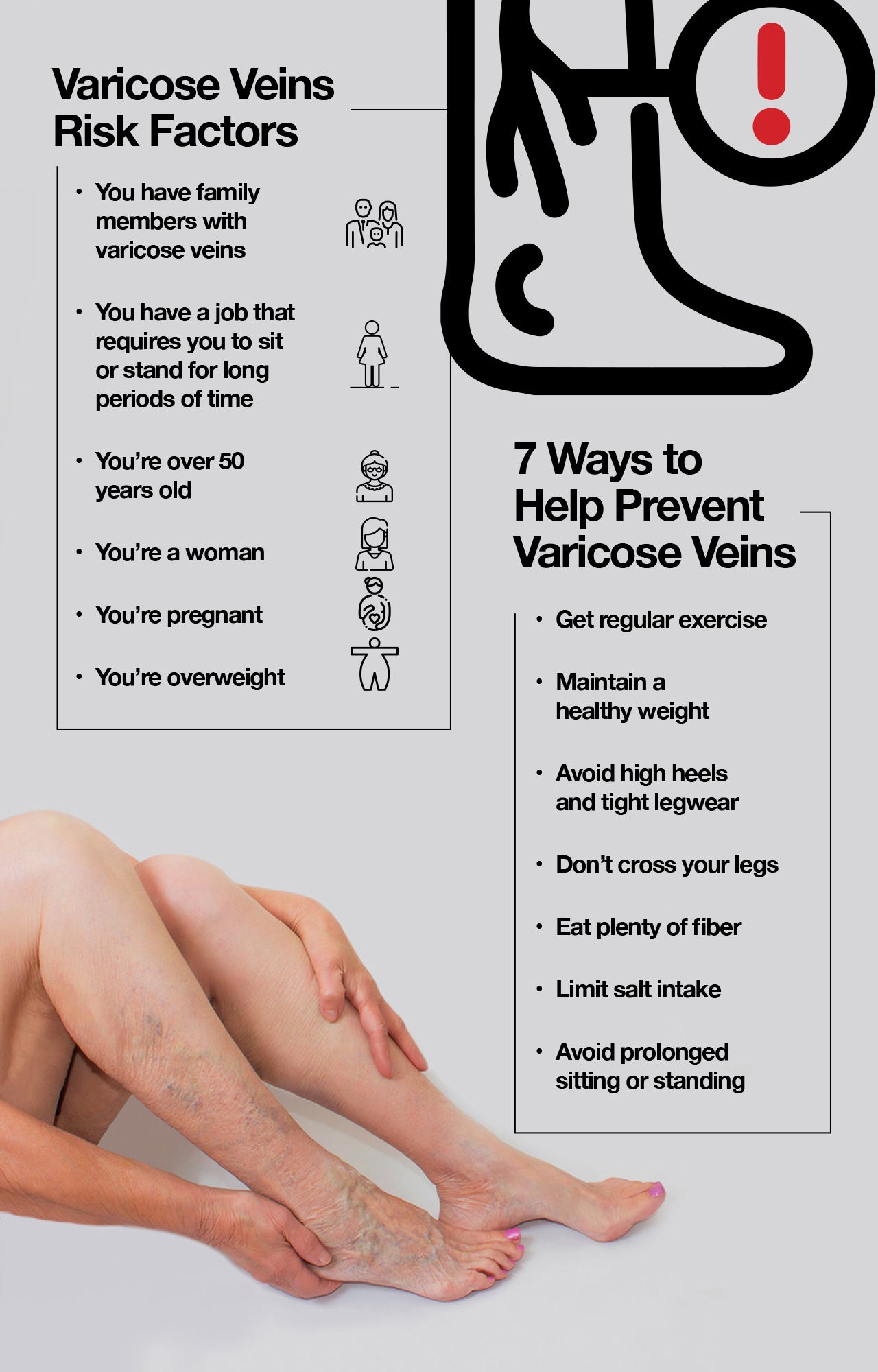 Varicose veins risk factors and prevention