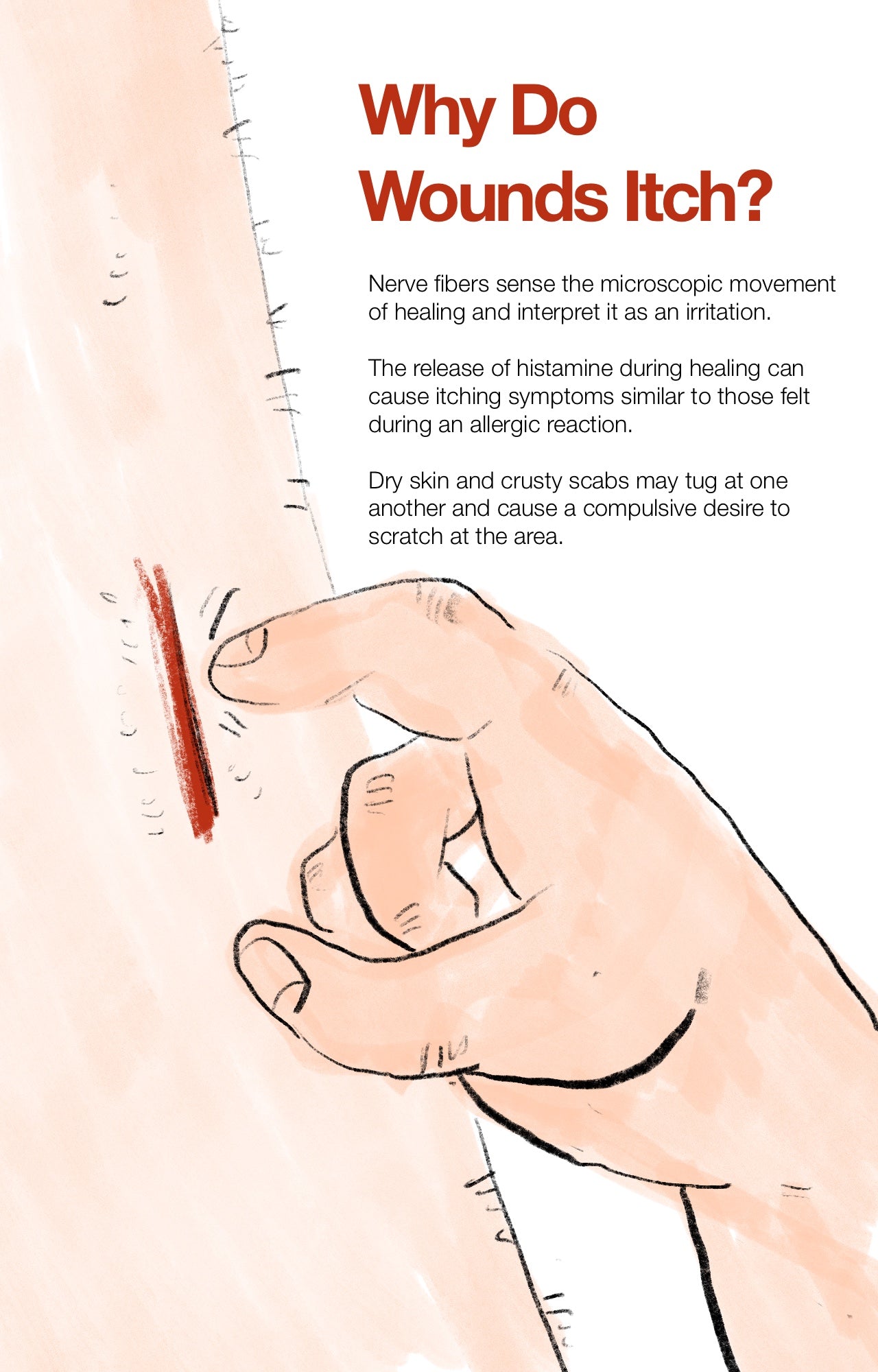 Why Do Wounds Itch?