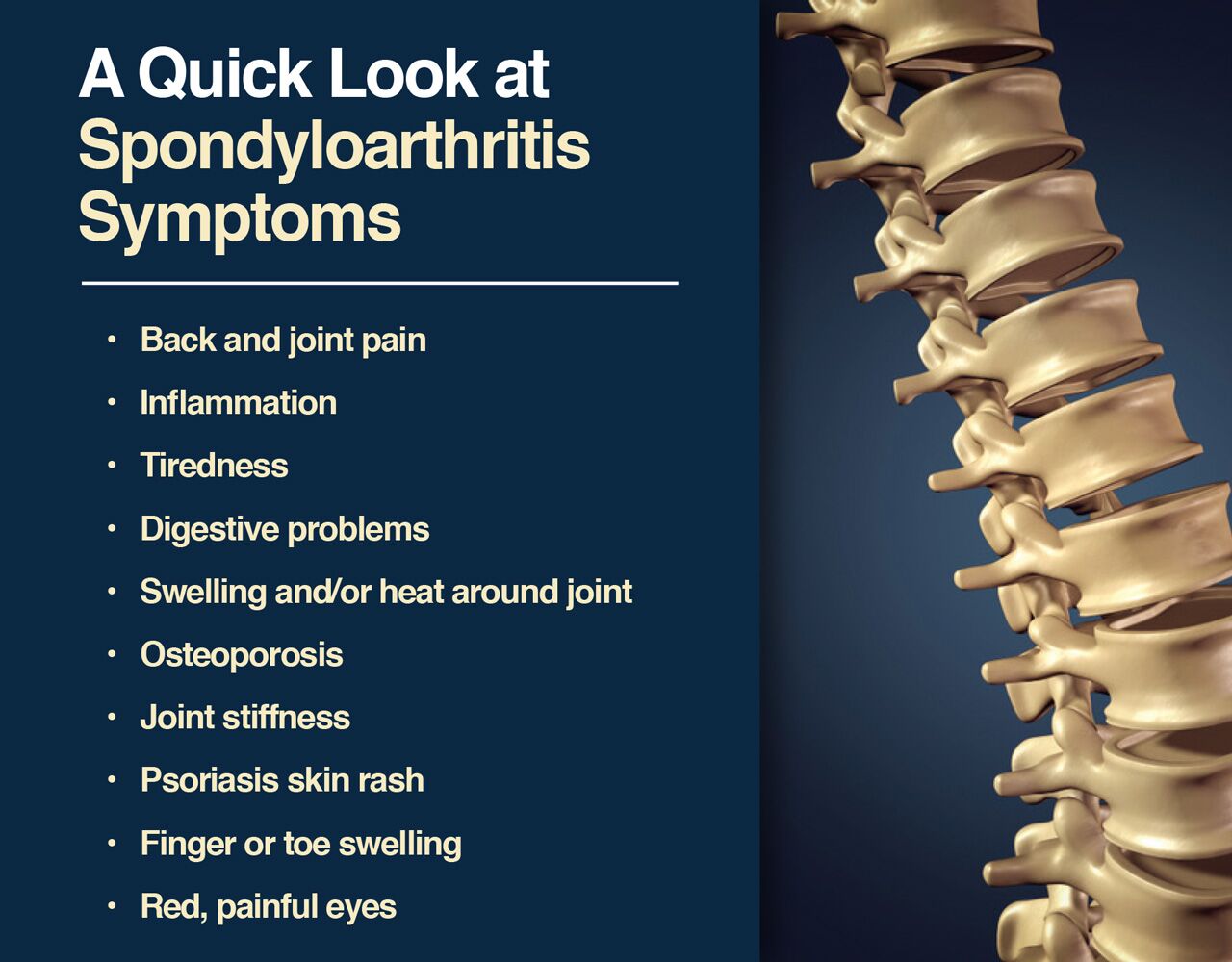 Spondyloarthritis symptoms