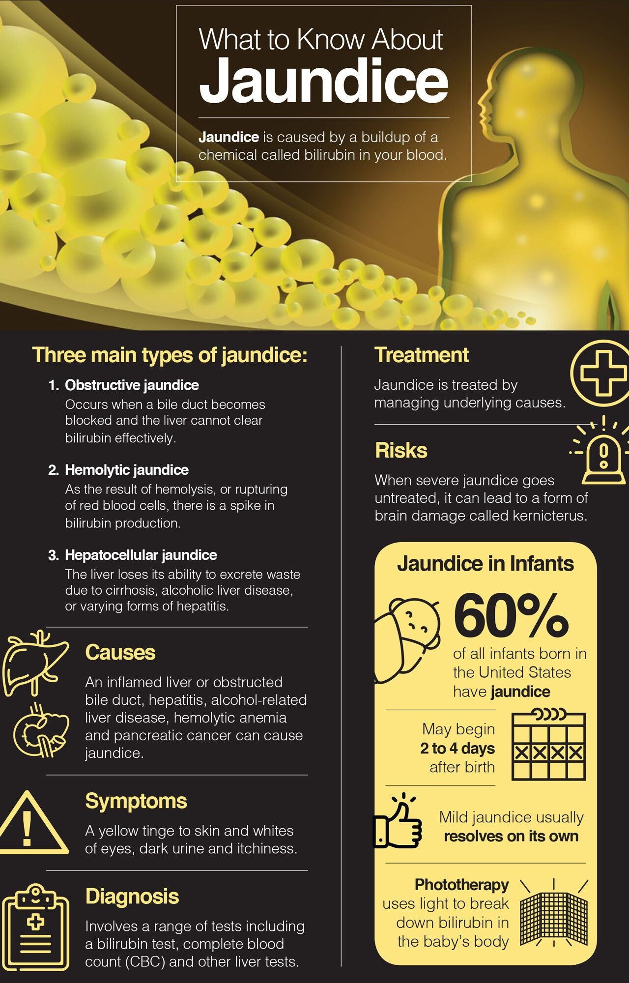 What to know about jaundice